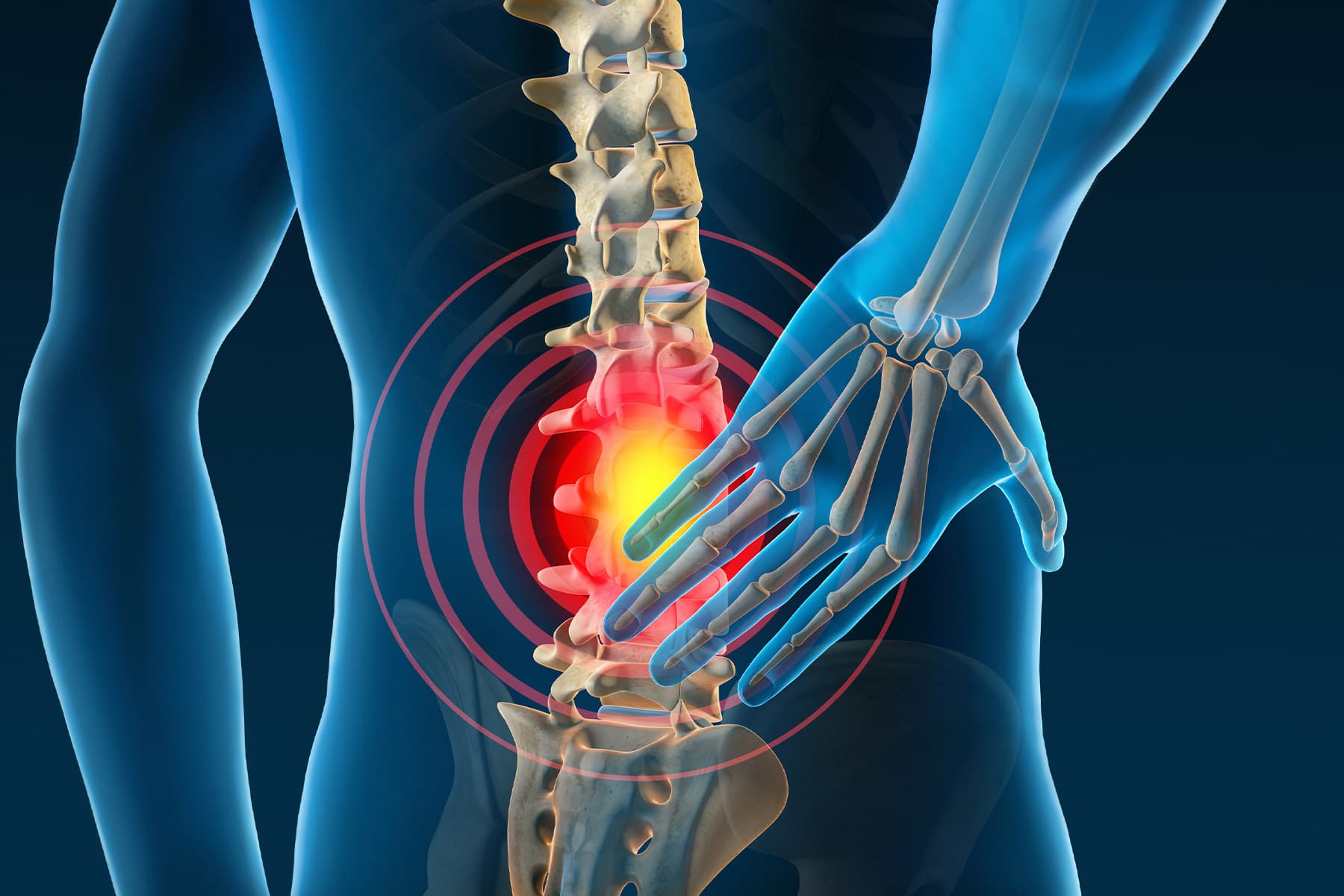 6 Ways to Improve Back Pain