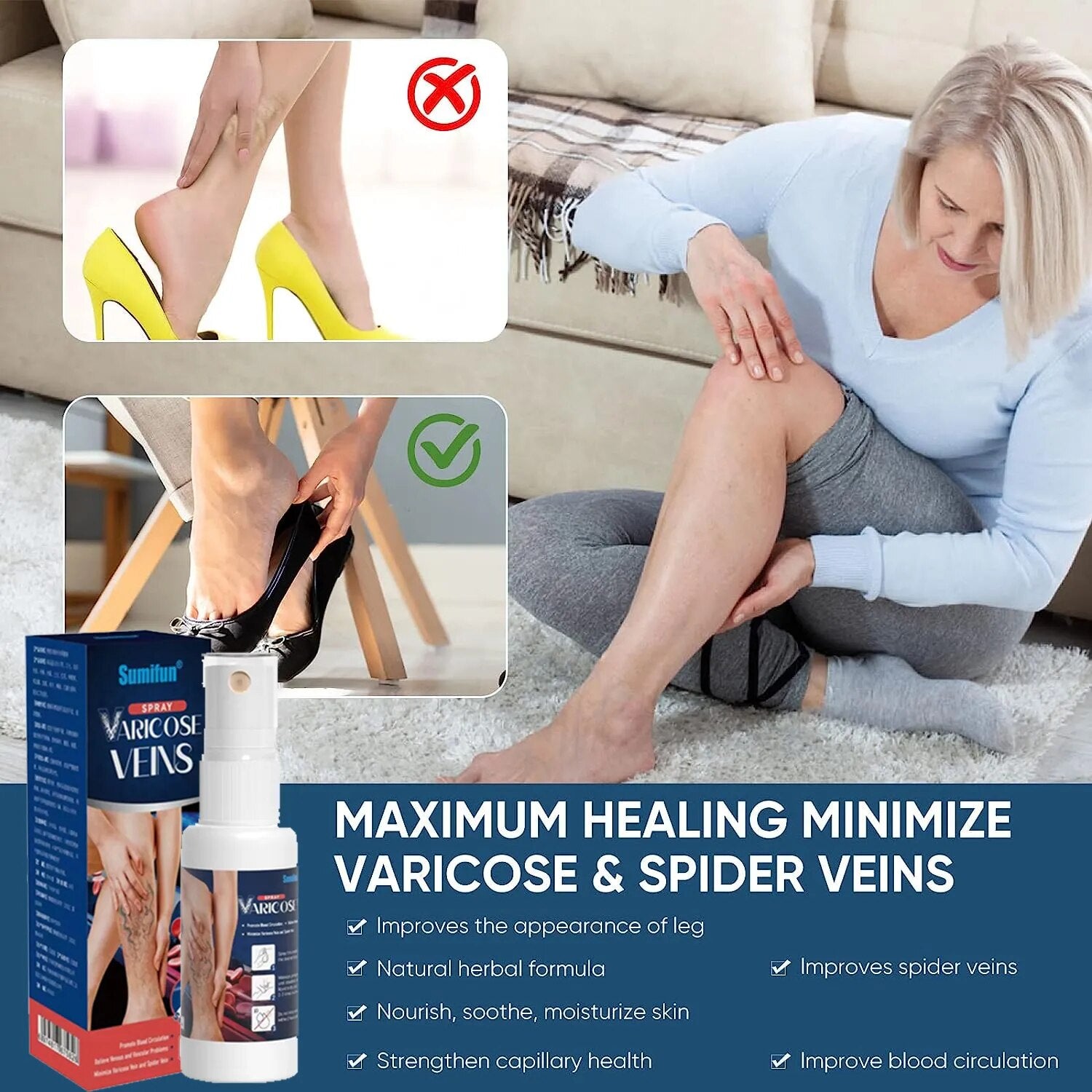 Varicose Veins Treatment for Leg Varicose Vein Cream Soothe Swelling and Strengthen Capillary Health Relief Spider Varicose Vein