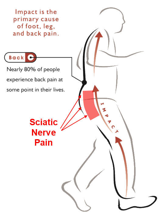 Sciatic Pain Relief From Z-CoiL