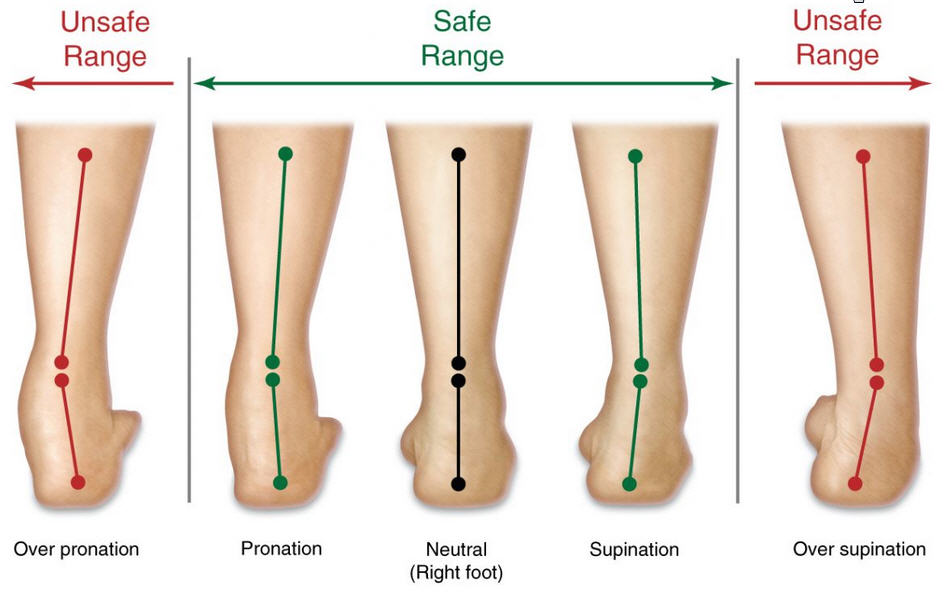 over-pronation-vs.-normal2.jpg