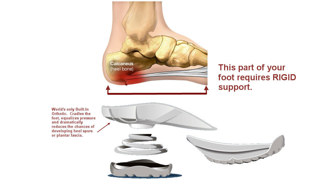 How to Get Rid of Heel Spurs - Vive Health