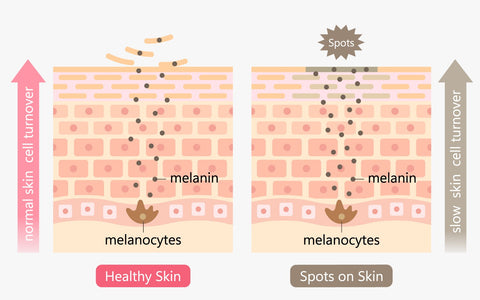 Skin renewal process