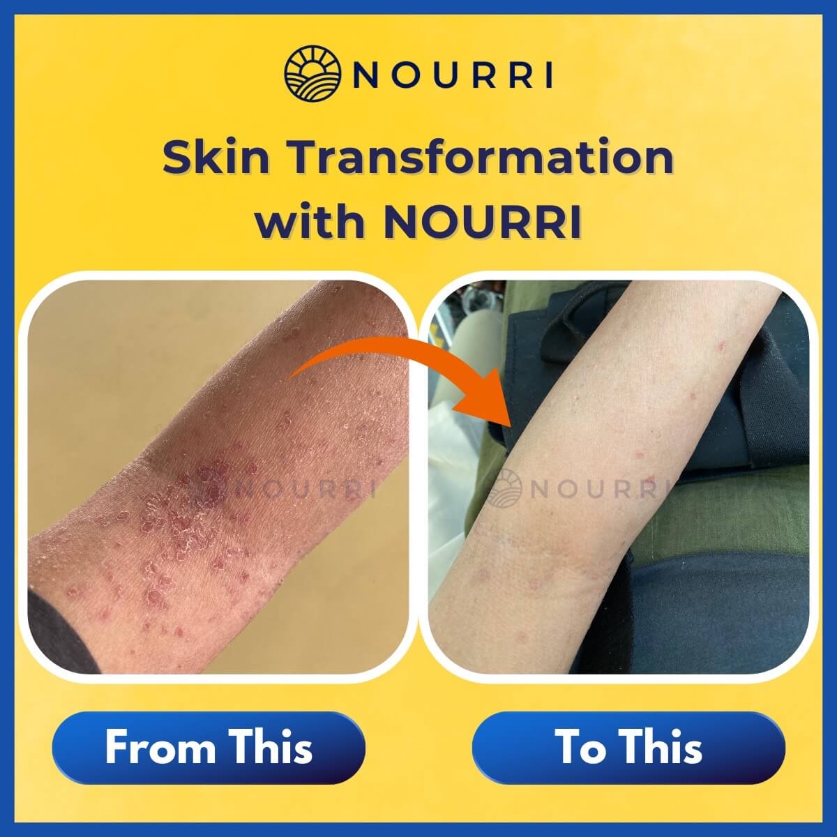 Skin Transformation with NOURRI.jpeg__PID:cde0b91a-698a-42c6-bca4-7d798ed85f63
