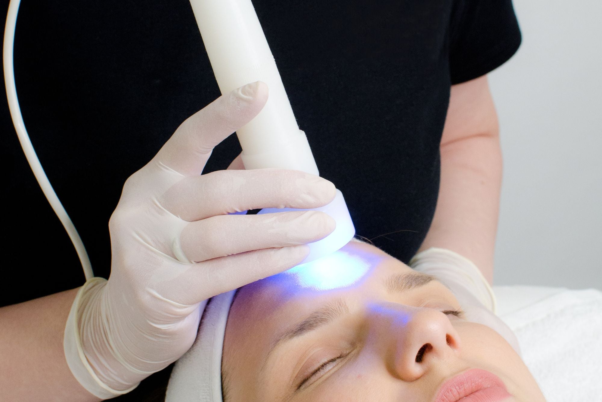 A woman lying down while someone uses blue light therapy to treat her acne.