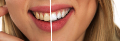 cocopull natural teeth whitening