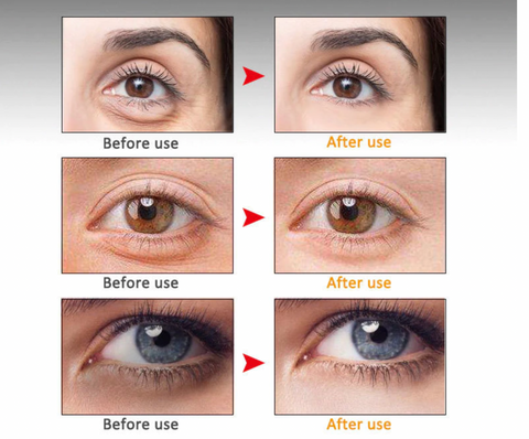 Anti-Wrinkle Eye Serum