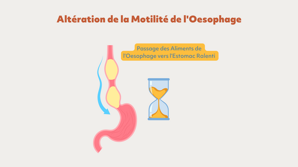 altération de la motilité de l'oesophage