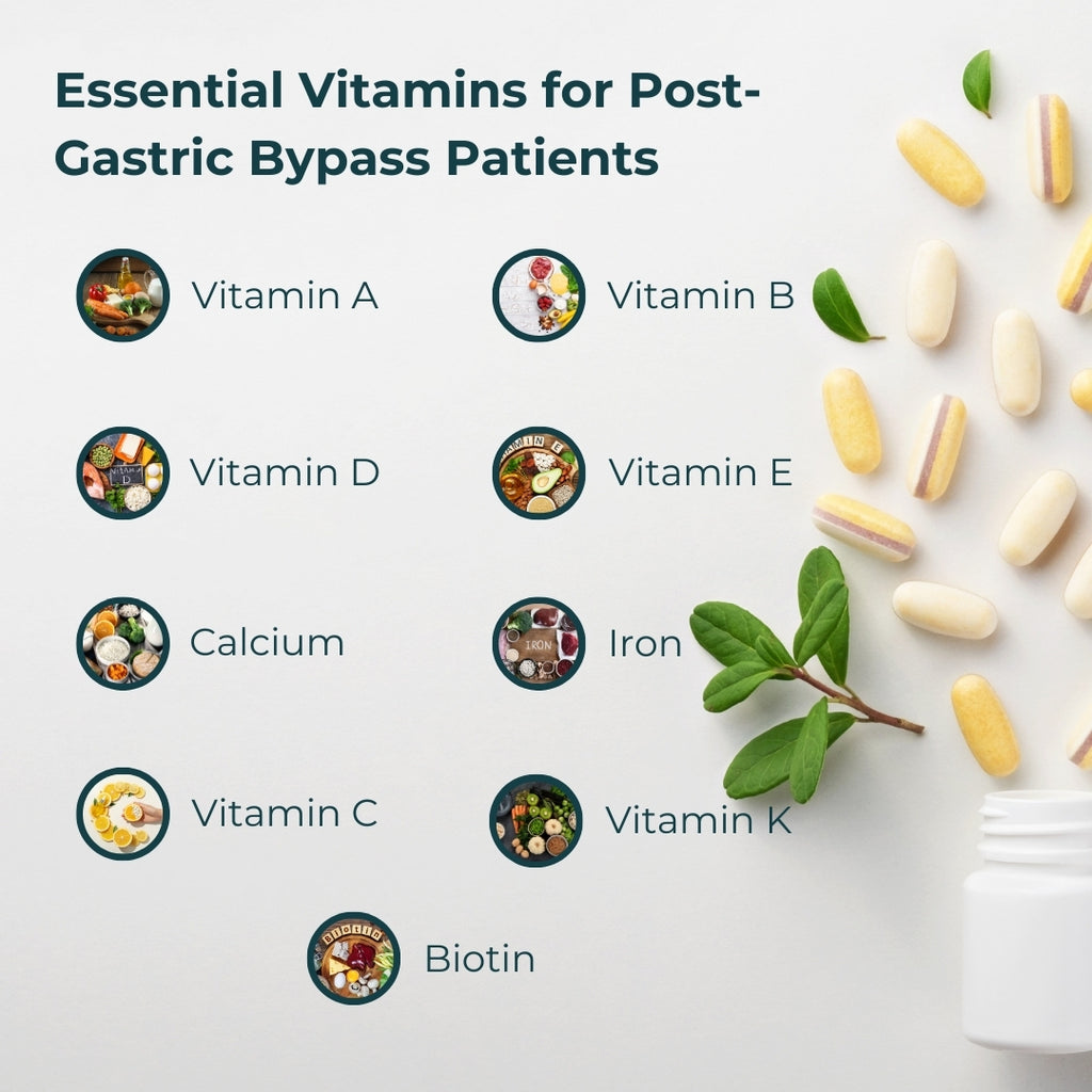 Essential Vitamins for Post-Gastric Bypass Patients