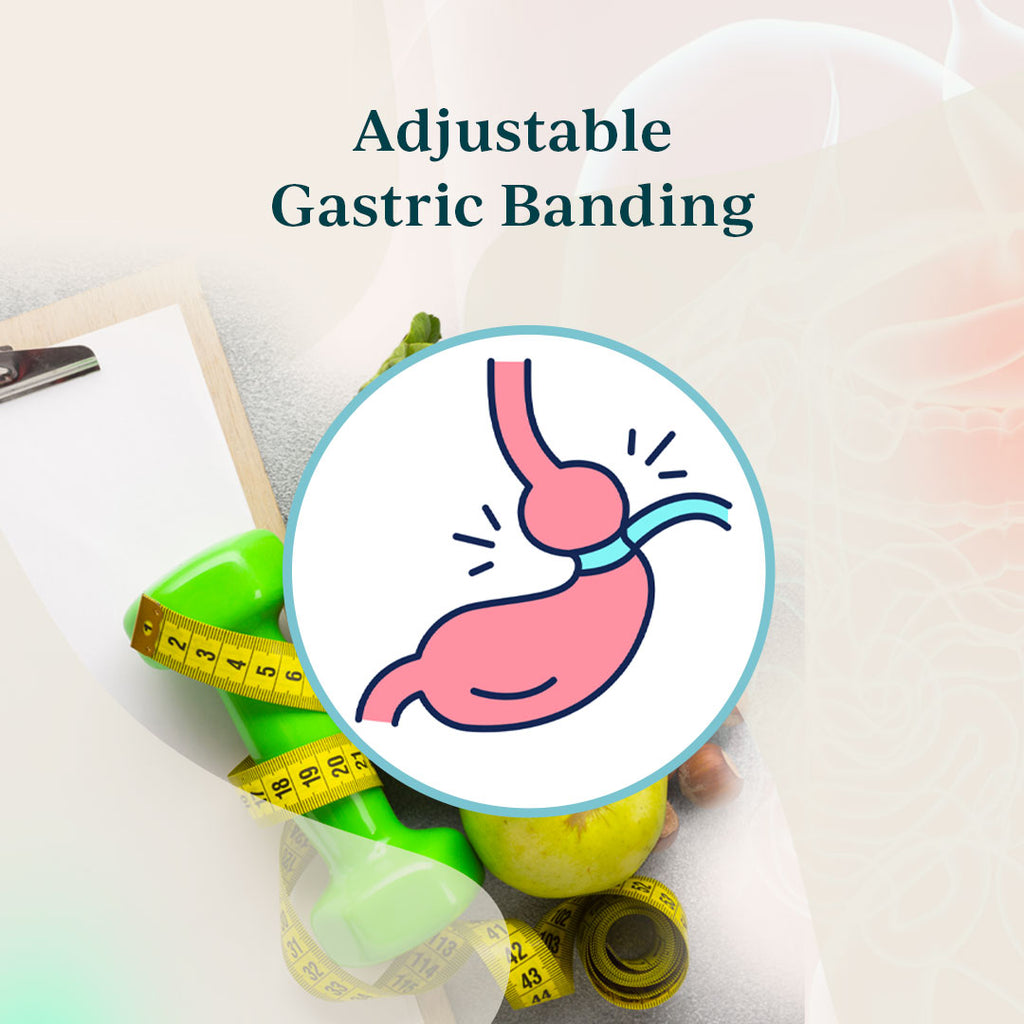 Adjustable Gastric Banding