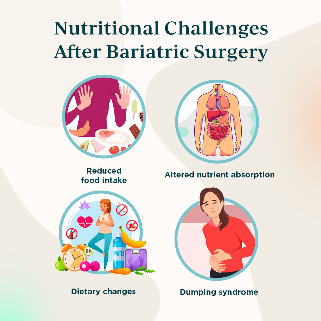Nutritional Challenges After Bariatric Surgery