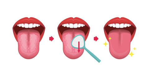 刷舌頭其實很簡單，只需要使用舌刮器或牙刷的背面輕刷舌頭