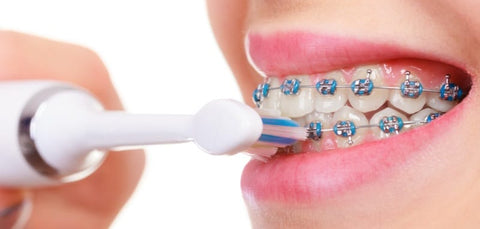 Brusheva電動聲波牙刷適用於矯齒人士