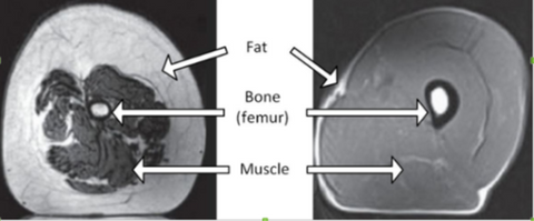 muscle cross section