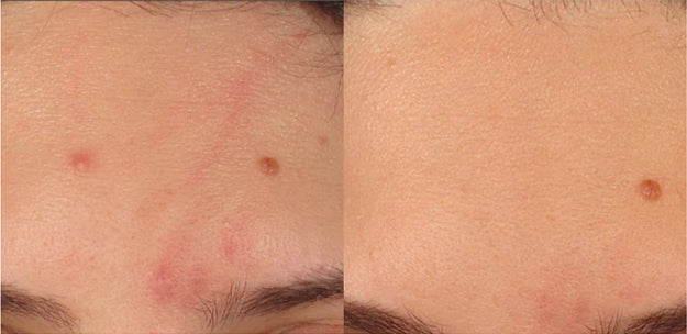 CLEAR CELL clarifying repair crème