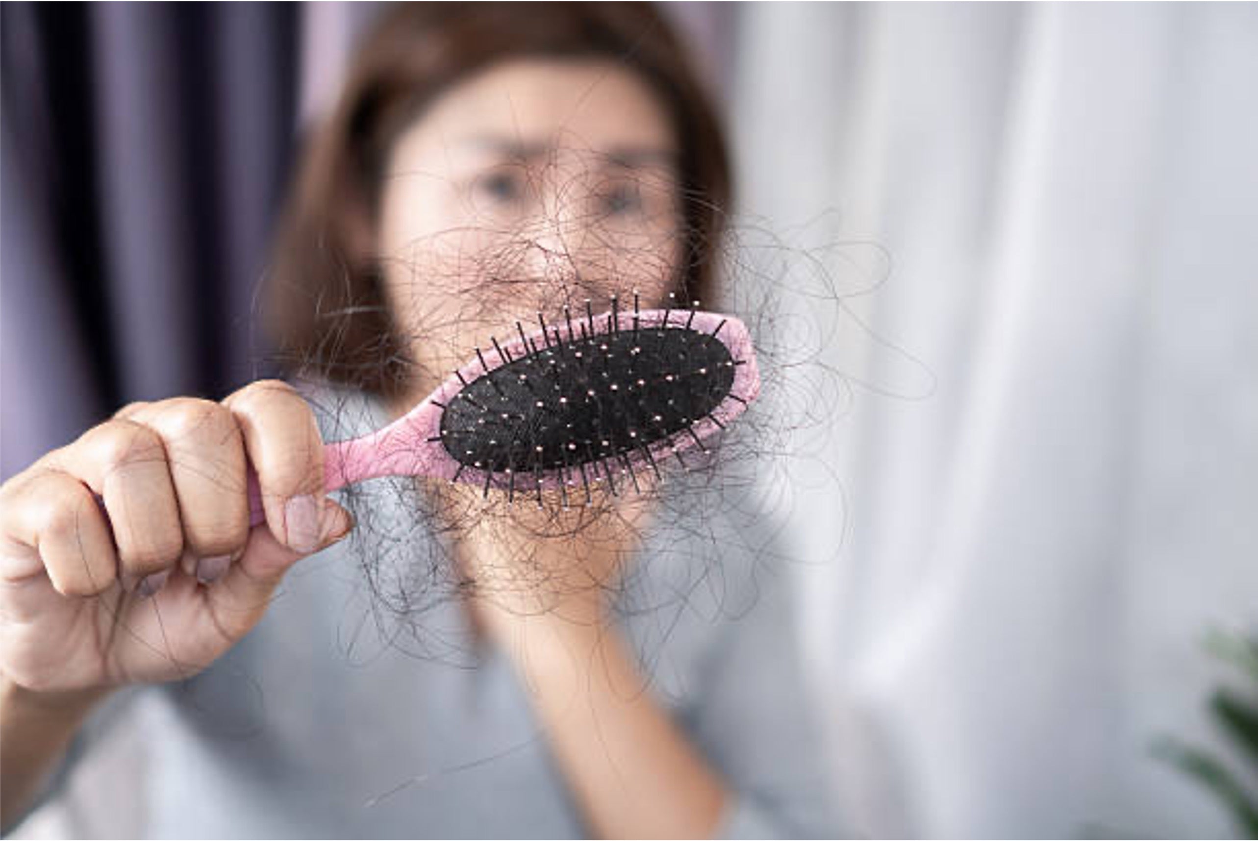 Image of a woman losing hair.jpg__PID:ecb7dbea-8dce-460b-881b-991b73a15755