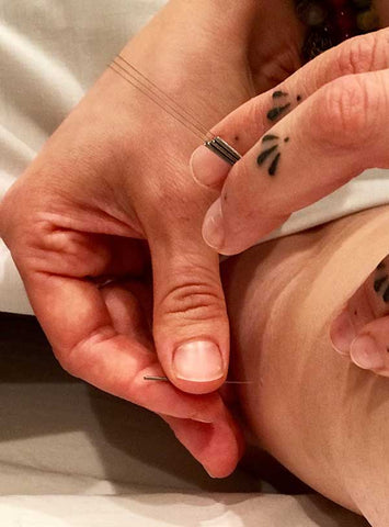 close up of hand placing an acupuncture needle into a leg