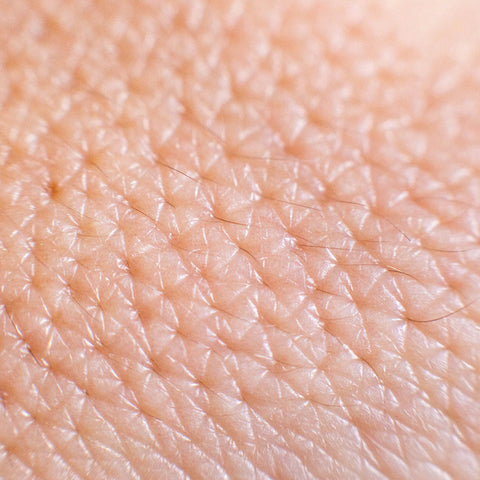 close up of skin with damaged skin barrier