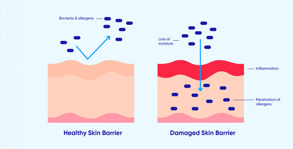 scientific drawing of damaged skin barrier