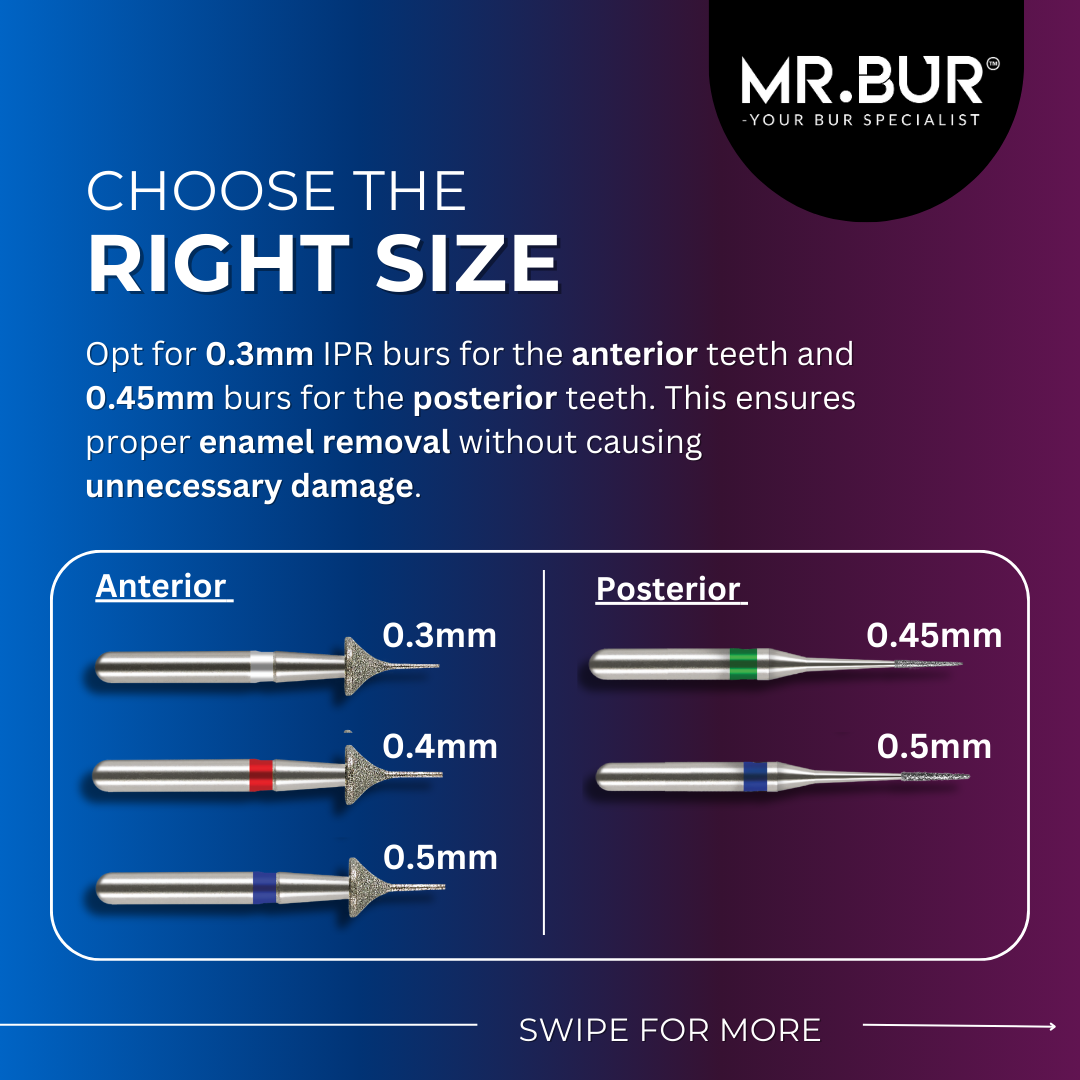  This picture explain the important of choosing the right size for IPR bur start from 0.3mm, 0.4mm, 0.45mm and 0.5mm for accurate reshaping of teeth to create space for the alignment of crowded teeth.