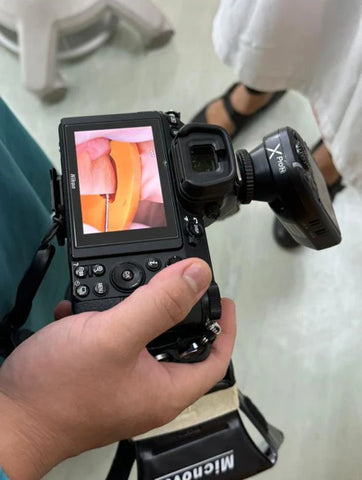 This is a high resolution camera being held by a dentist and the camera screen shows a high resolution image of a zoomed in view of a dental procedure using the dental burs sold by mr bur the best dental bur supplier in the world