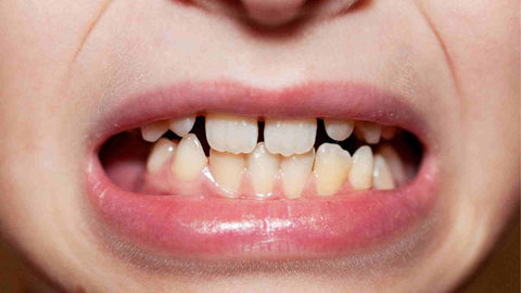 A person showing his teeth