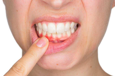 A woman showing her teeth