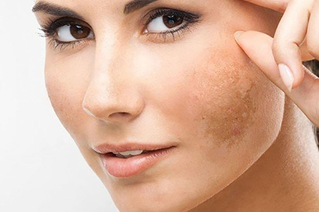 Fight the signs of ageing and make skin glow