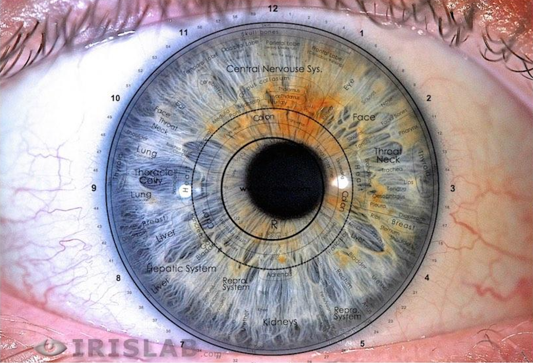 Detailed iris chart highlighting specific zones used in iridology for health analysis