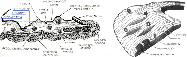 Excerpt from Bernard Jensen's 'Iridology Simplified', discussing disease degradation stages and their impact on health.