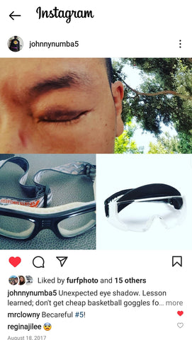 2017 Instagram post about how basketball goggles caused an eye injury in Jiu Jitsu