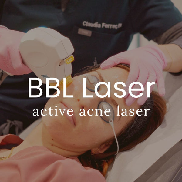 Active Acne Treatment with Broadband Light Therapy (BBL®)