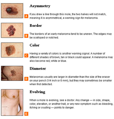 The ABCs Of Skin Cancer: A Guide - Blue Lizard