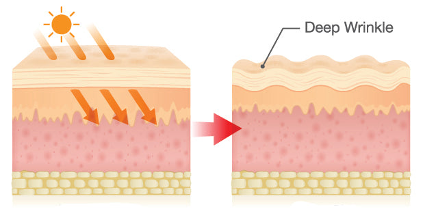 A diagram illustrating how UV rays cause wrinkles. 