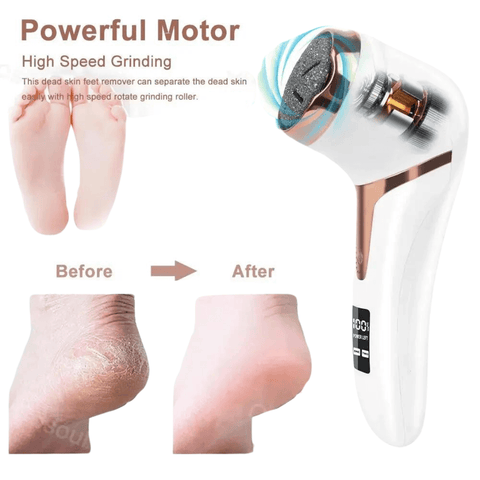 Pampered-Feet-in-Minutes-Cushy-Footsie-Professional-Electric-Foot-File-motor