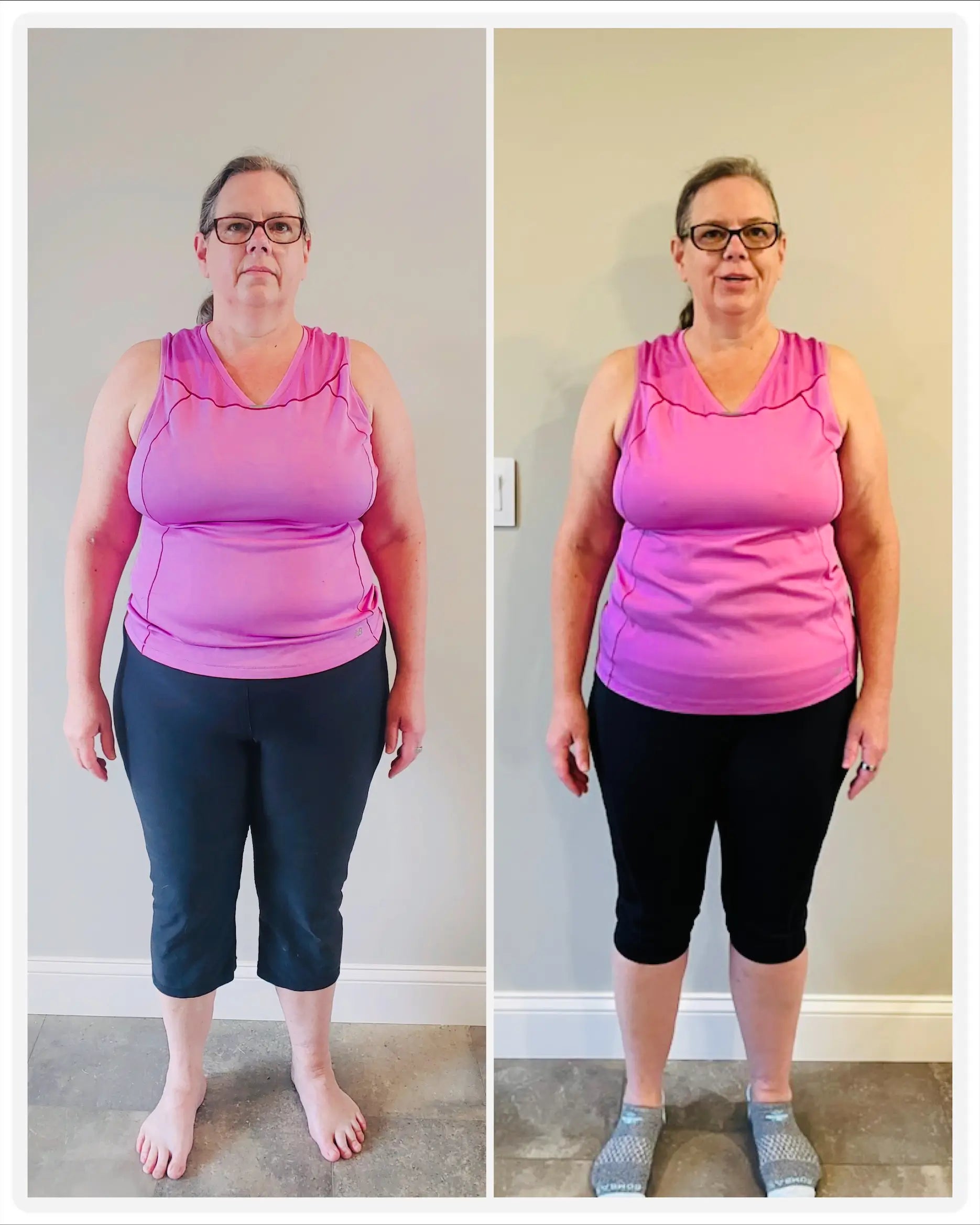 Slimoly™ GLP-1 Oral Melt Pearls