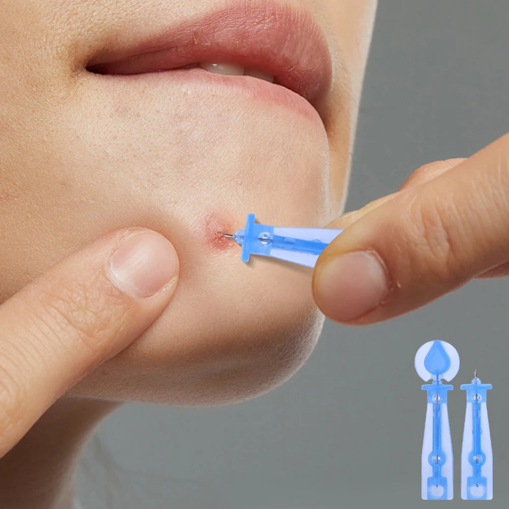 Disposable Blackhead Removal Needles