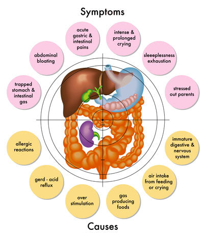 Symptoms and Causes 