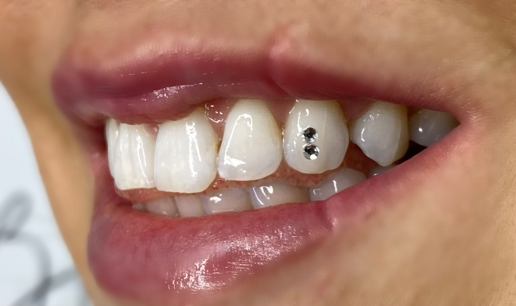 Tooth gems make smiles sparkle