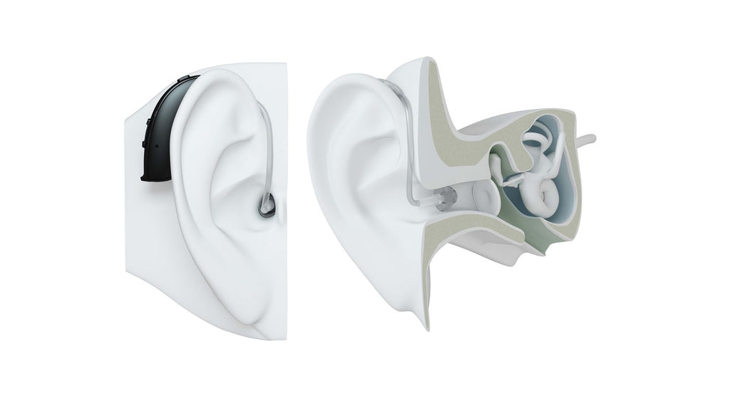 Behind-The-Ear Hearing Aids Illustrations @ SOUNDLIFE Hearing Center