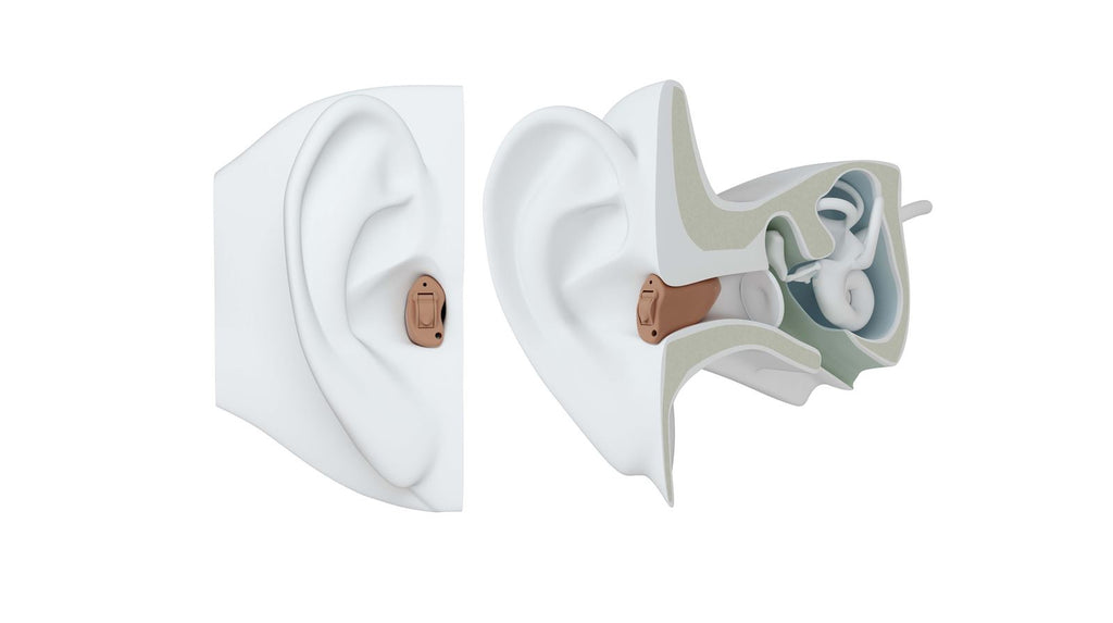 Completely-In-Canal (CIC) Hearing Aids @ SOUNDLIFE Hearing Center