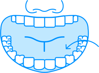 lower-teeth-impression