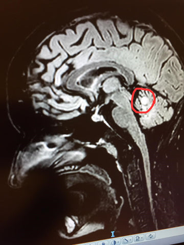 MRI van Fennies hoofd