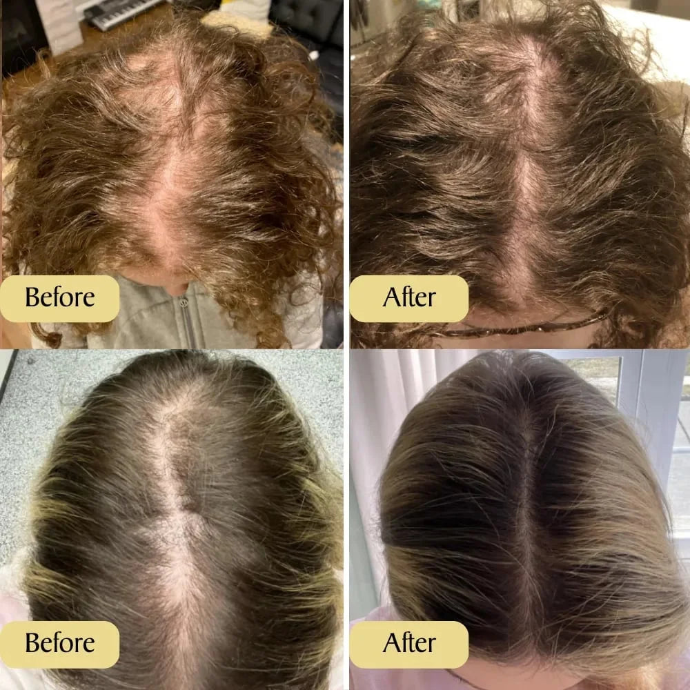 Natural Hair Growth Oil - Image 6