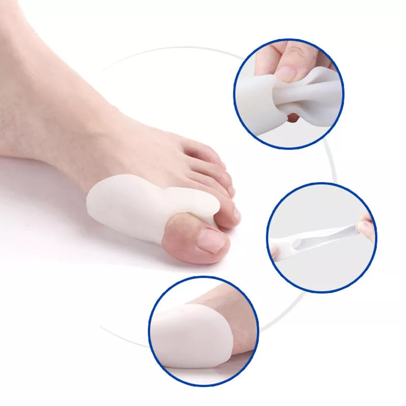 Silicone Toes Valgus Corrector - Image 16