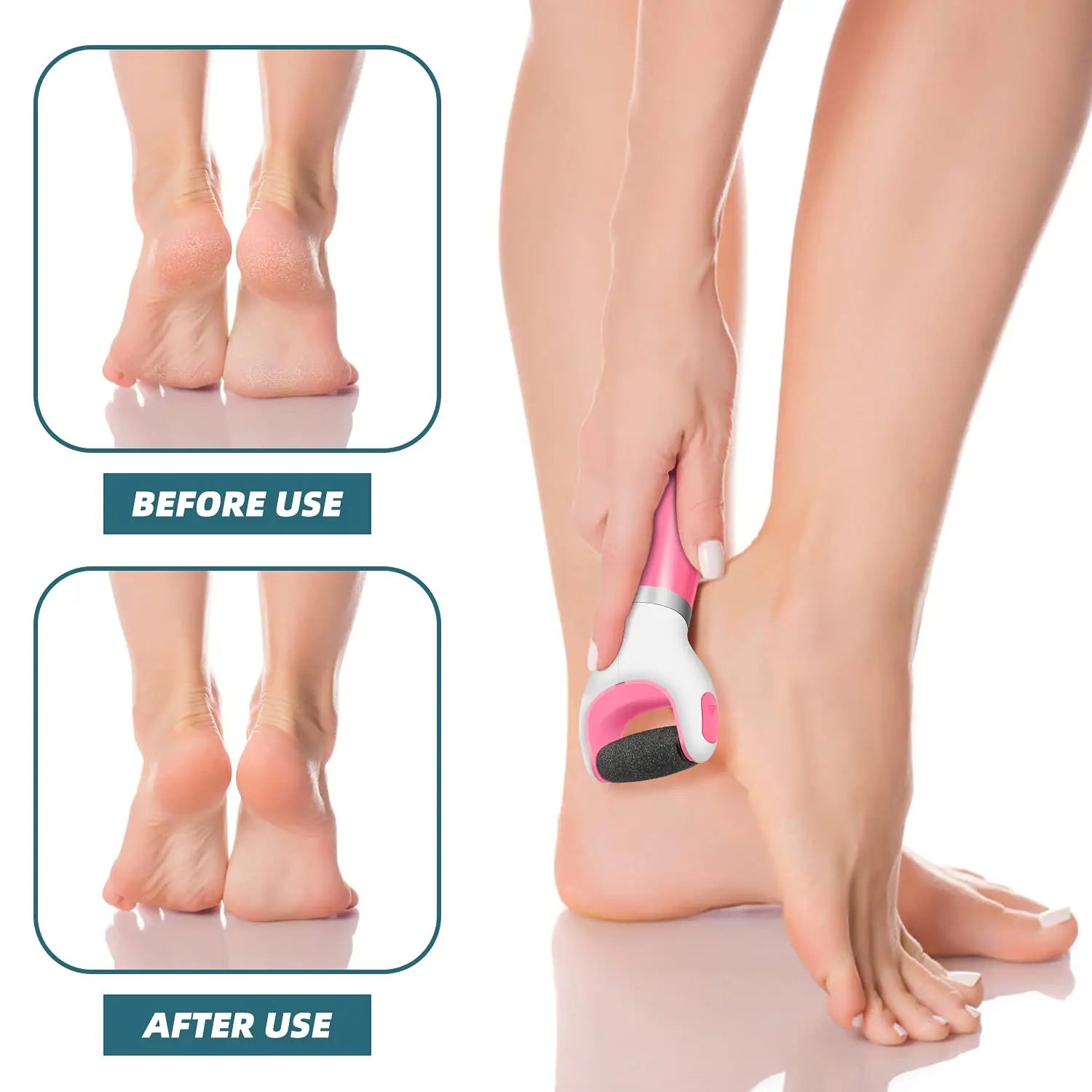 Usb Foot Callus Remover Pedicure Tool - Image 8