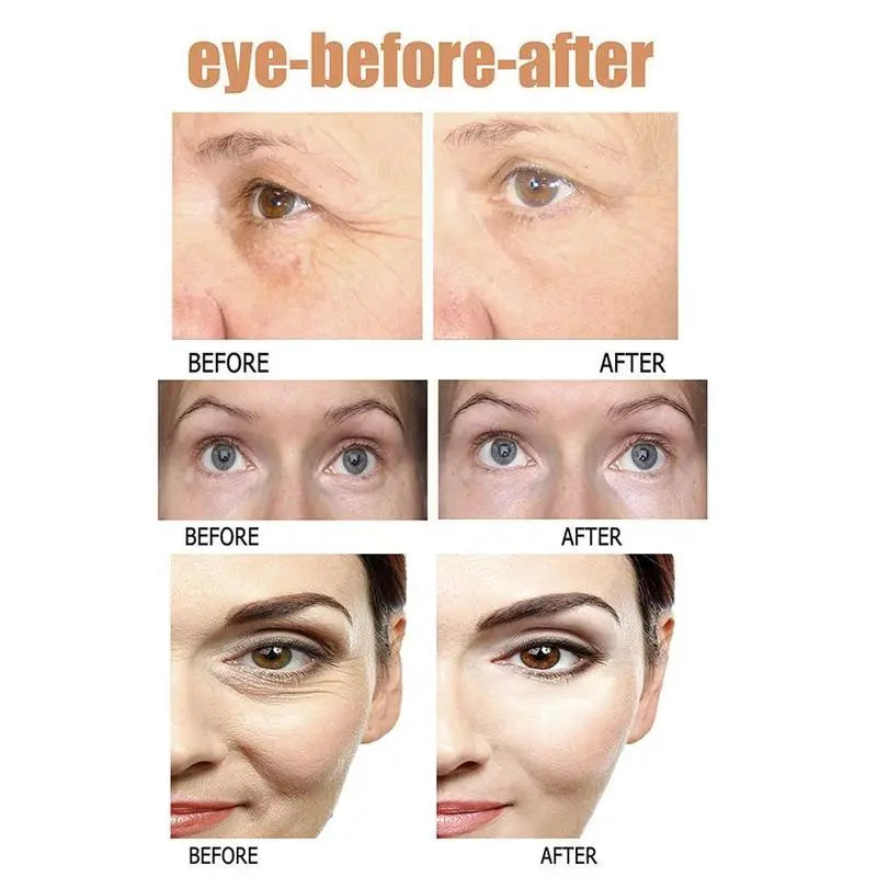Instant Eye Bag Removal - Image 9