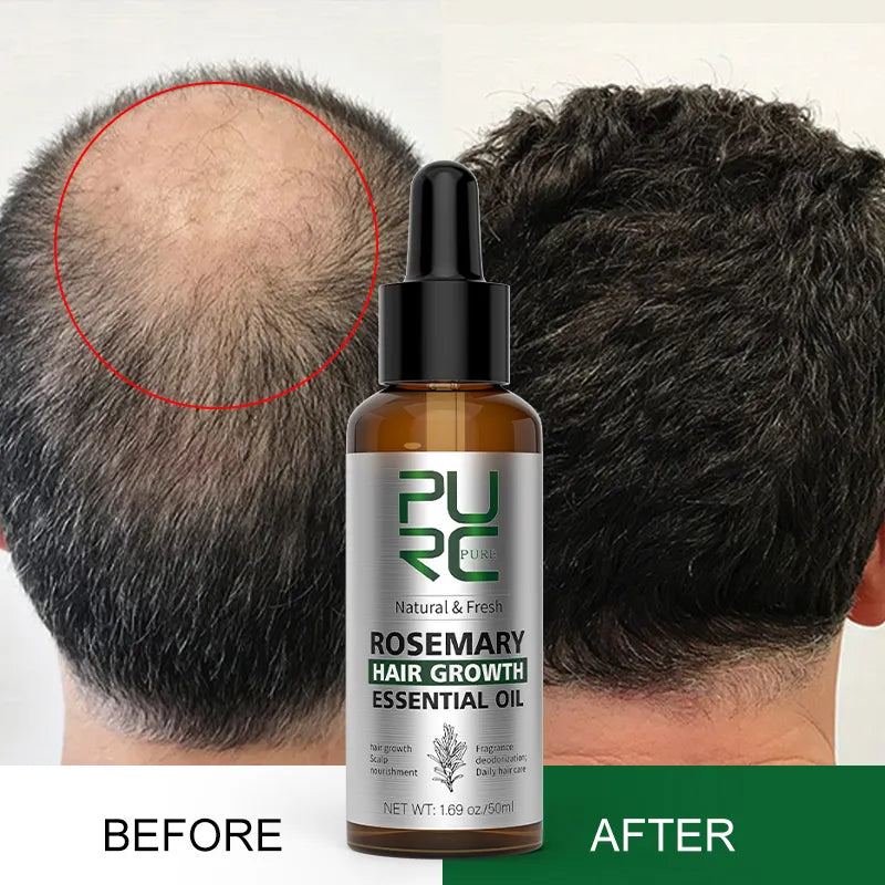 Alternative view of Rosemary Hair Growth Essential Oil