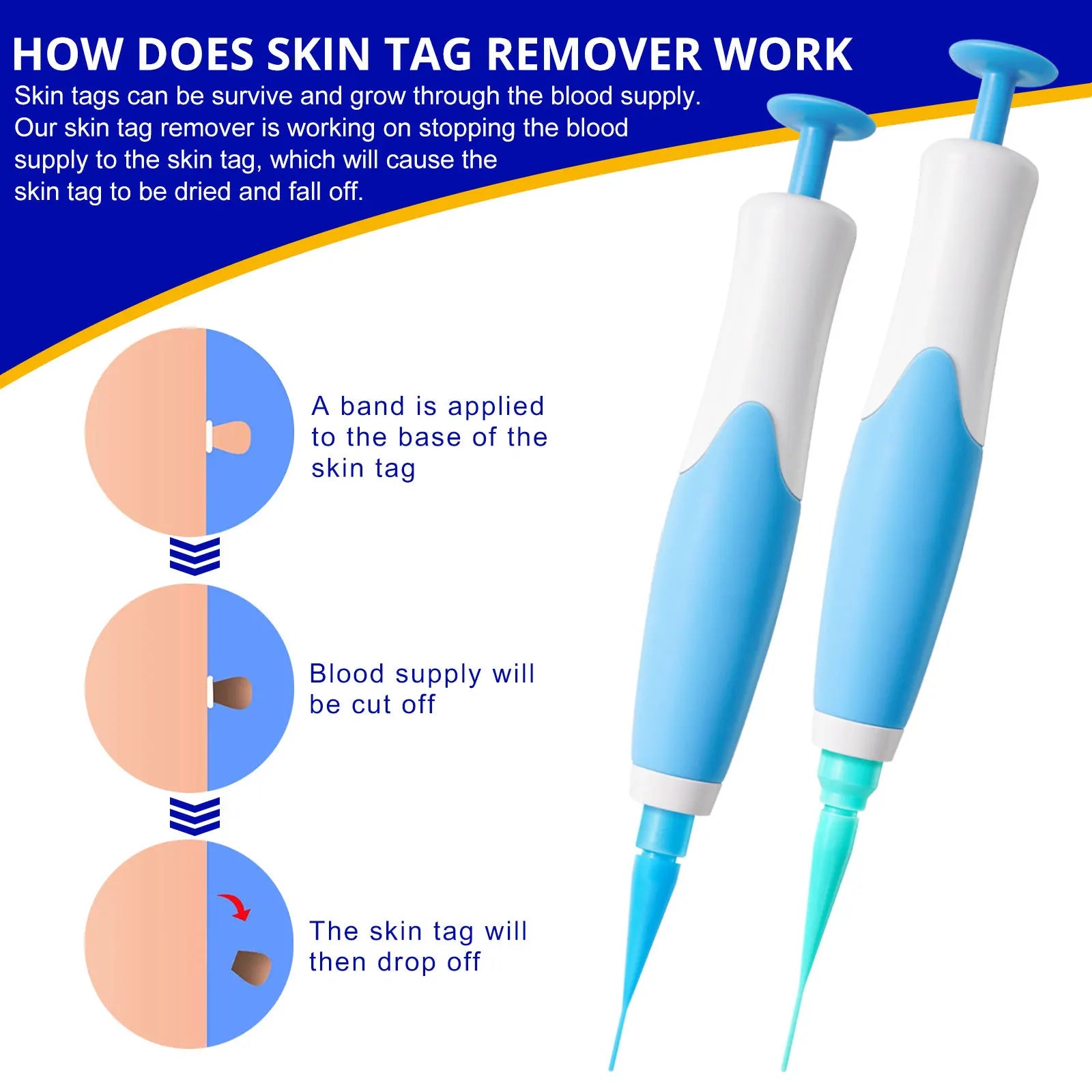 Skin Tag Removal Kit - Image 7