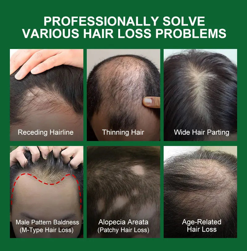 Rosemary Hair Growth Essential Oil - Image 8