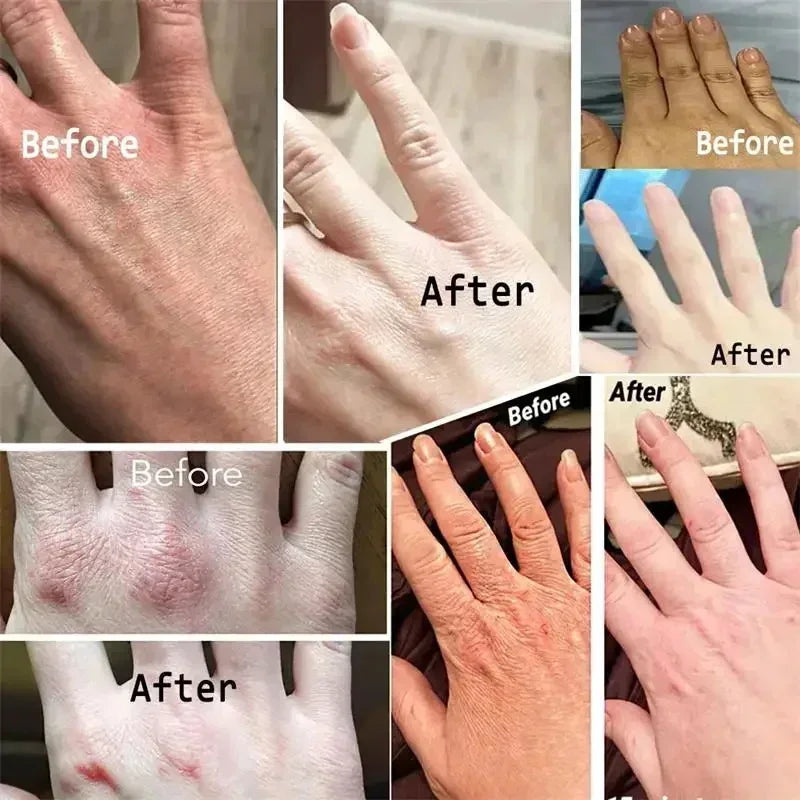 Anti-Wrinkle Hand Cream - Image 5